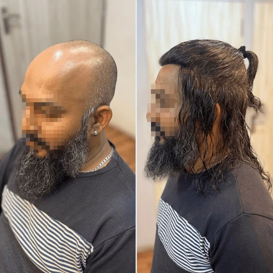 A Topee client before and after a hair system fitting