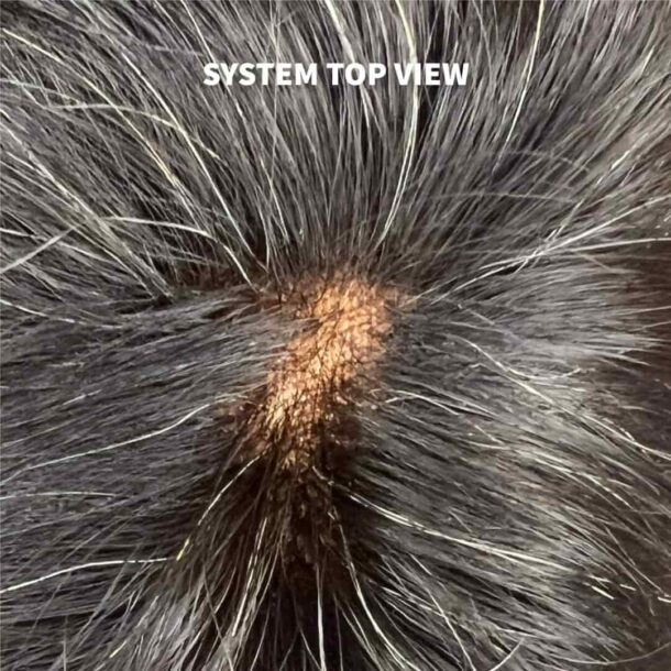 Topee Fully Customised Full Lace Hair Patch - Image 2