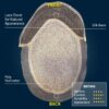 Topee Silk Base Hair Patch With Lace Front & Poly Sides | Ultra Natural Hair Quality - Image 3