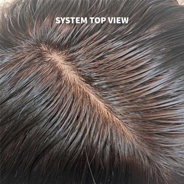 Topee Silk Base Hair Patch With Poly Sides And Superior Hair Quality
